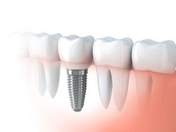 TI | Medical | Specialty Metals | Medical Alloys